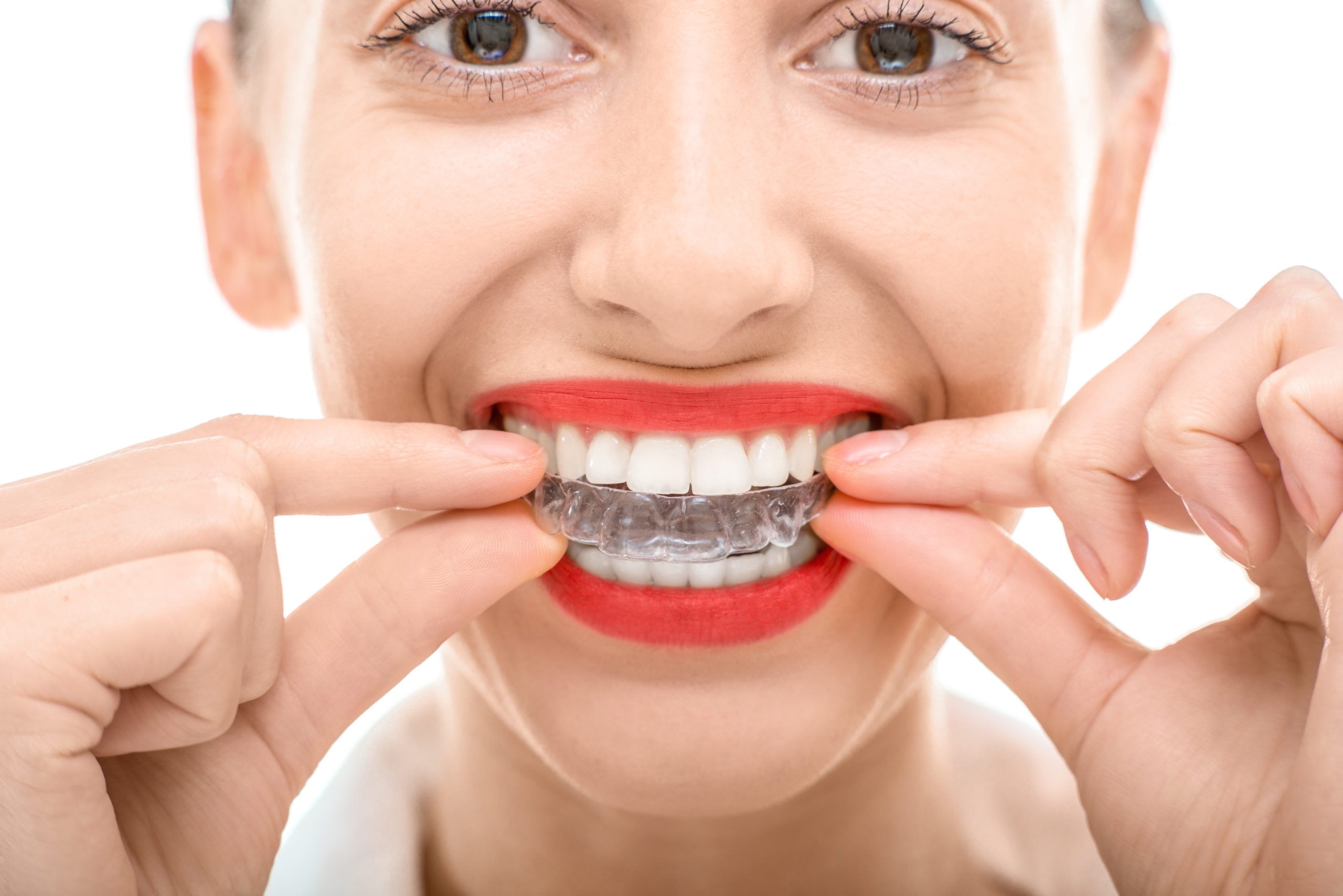 Invisalign Alpharetta - Newpark Orthodontics