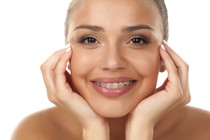 Adult woman with Braces