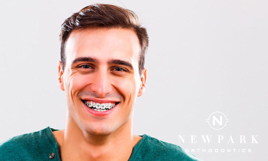 Adult Braces Alpharetta - FAQs