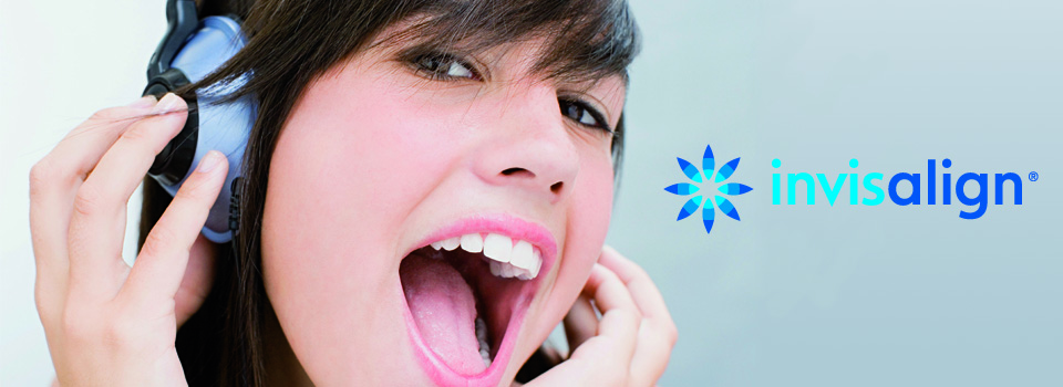 Invisalign social occasion