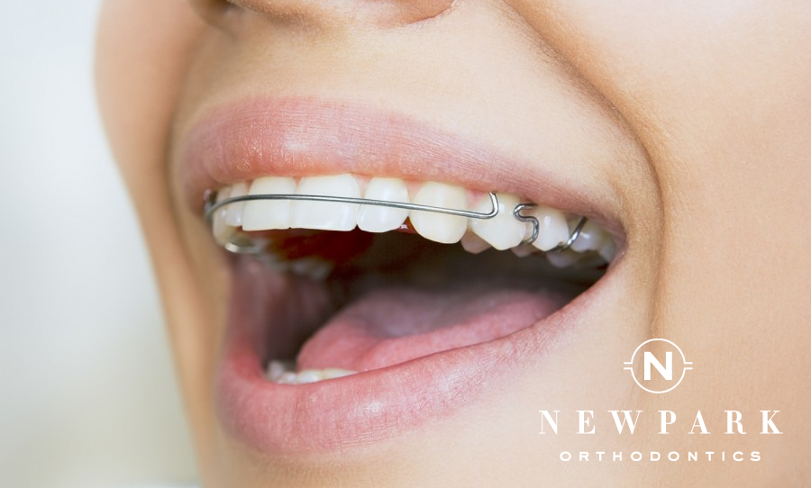 Post Braces Treatment - Newpark Orthodontics