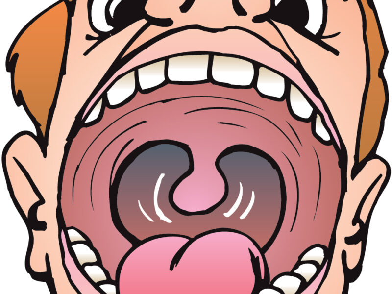 Palatal Expanders in Alpharetta, Johns Creek & Roswell