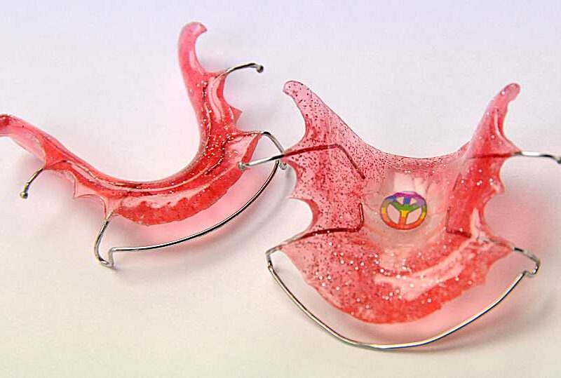 Retainers in Alpharetta, Johns Creek & Roswell