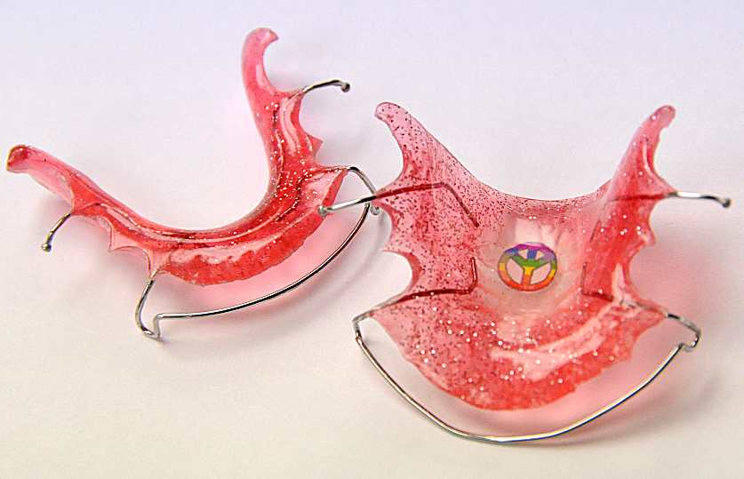Retainers in Alpharetta, Johns Creek & Roswell