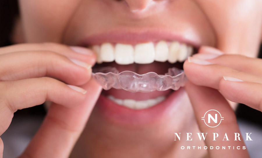 Invisalign Aligners - Newpark Orthodontics