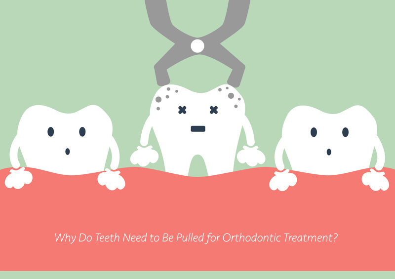 Tooth Extraction cartoon