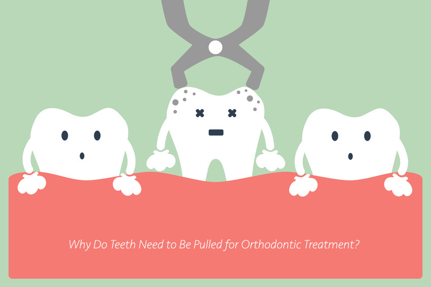 Tooth Extraction cartoon