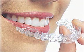 Invisalign Treatment in Alpharetta, Johns Creek and Roswell