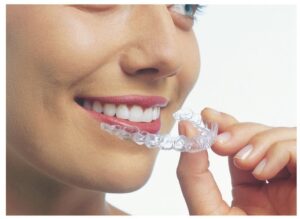 Newpark Ortho Alpharetta Teen Invisalign
