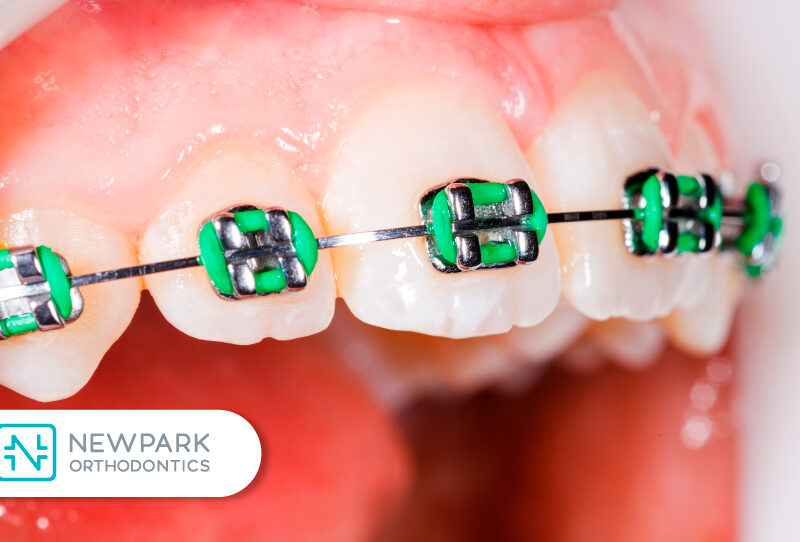 the history of braces teaches us a lot about orthodontics and what we can do.