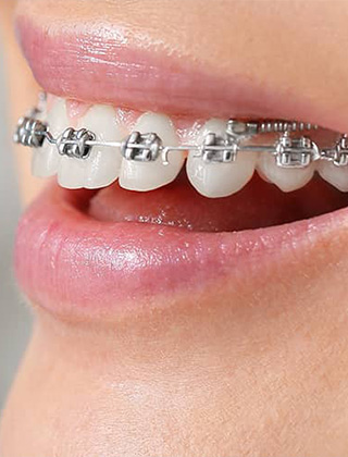 img-header-treatment-tad-01