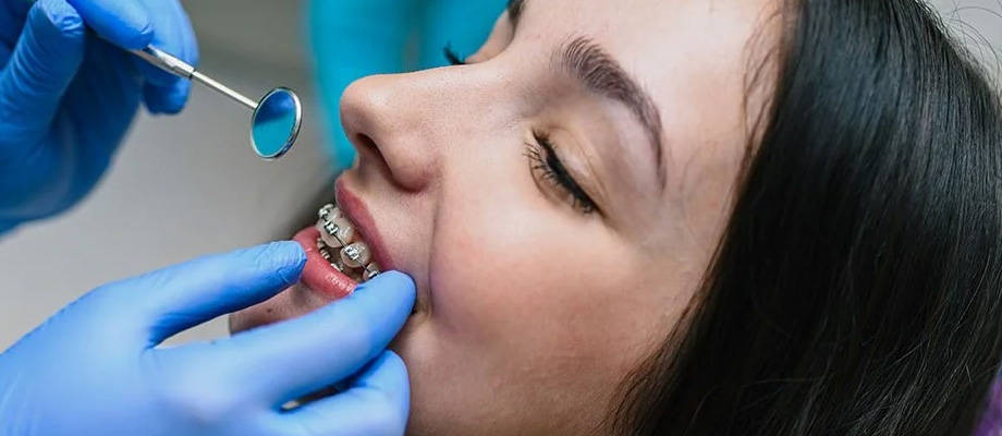 img-newparkorthodontics-adultbraces-04