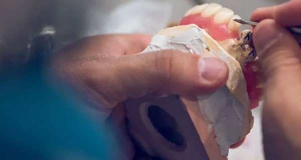 img-newparkorthodontics-blog-2