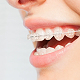 img-newparkorthodontics-johnscreek-inovation