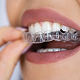 img-newparkorthodontics-johnscreek-invisalign