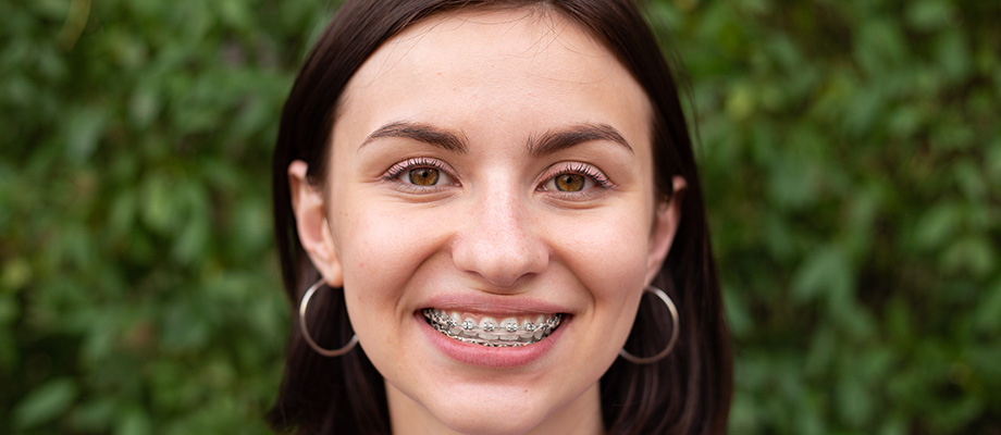 img-newparkorthodontics-lifewithbraces-03