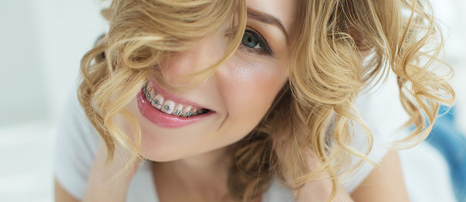 img-newparkorthodontics-metalbraces-03