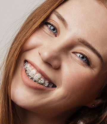 img-newparkorthodontics-treatment-braces-orthodonticemergrncies