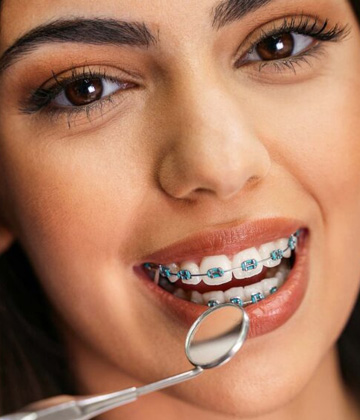 img-newparkorthodontics-treatment-braces-typesofbraces