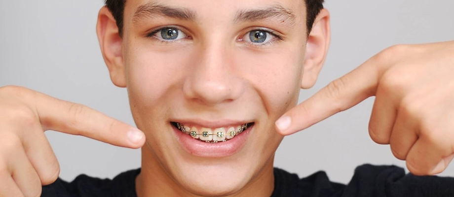 img-newparkorthodontics-typesofbraces-05