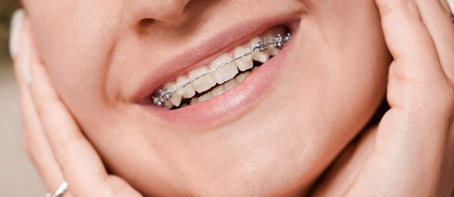 img-newparkorthodontoics-rosewell-braces-01